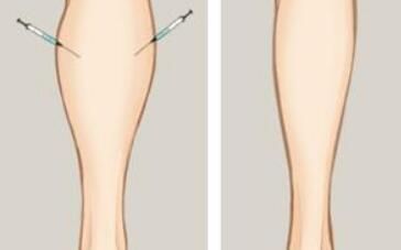 鄭州天后醫(yī)療美容醫(yī)院有哪些病例分享？