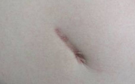 武漢頂尖眼袋整形醫(yī)生綜合評比當(dāng)?shù)刂t(yī)師資料公開揭曉