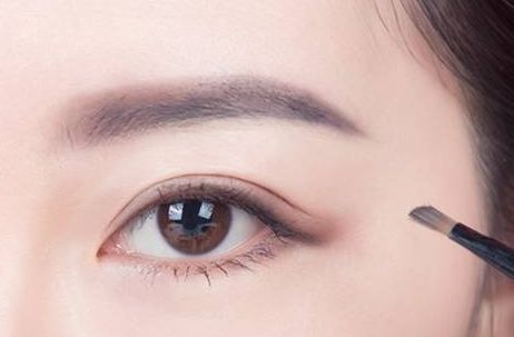 蜜月時光，揭秘黃筱琳醫(yī)生傾情打造的上海九院雙眼皮！2023年最新案例給你參考！