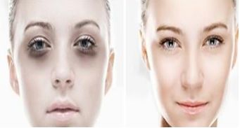 上海第九人民醫(yī)院正頜正畸：專家團隊幫您獲得完美笑容