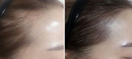 鄭州芳藝醫(yī)療整形醫(yī)院有沒(méi)有特色項(xiàng)目？如何一鍵獲?。? style=