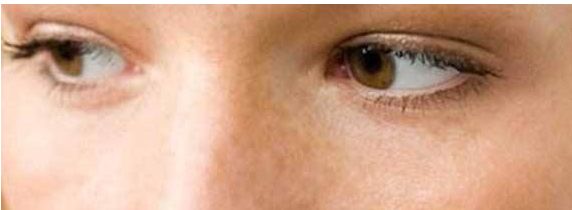 想改善雙眼皮？來鄭州三院看看王江允！了解費(fèi)用可參考2023價(jià)格表。