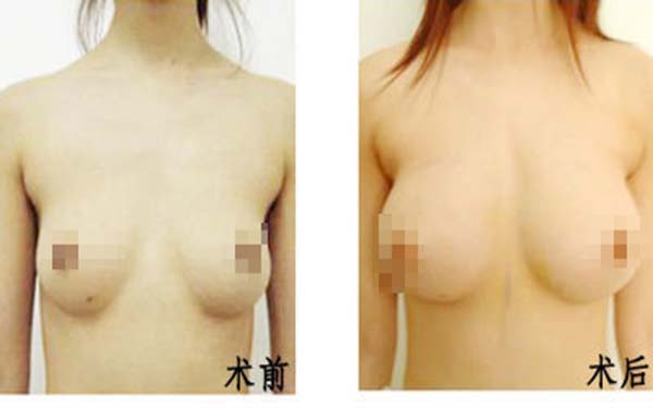 遂寧伊莎貝拉醫(yī)學美容門診部醫(yī)生是否值得信賴？他們的專業(yè)素質(zhì)如何？