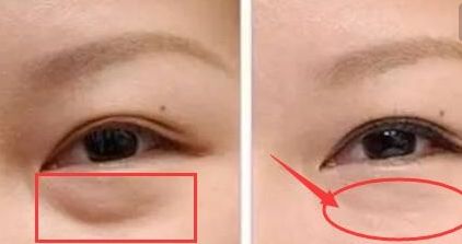 揭秘昆明雙眼皮明星醫(yī)生！驚喜榜單出爐，內(nèi)有杜海寬、王靜等大咖名醫(yī)！