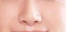 袁斯明醫(yī)生手術(shù)預(yù)約時(shí)效如何？祛疤效果有多好？解讀金陵醫(yī)院專家信息！