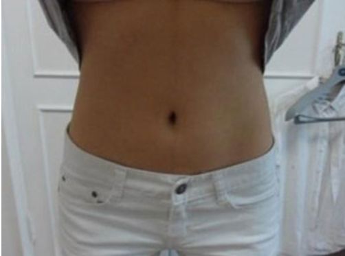 國(guó)內(nèi)知名雙眼皮大師推薦名單，附蘇薇潔、魏志香、王世勇等醫(yī)師！