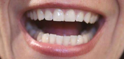 申霄與銀山：雙眼皮醫(yī)生大PK！誰更出彩？