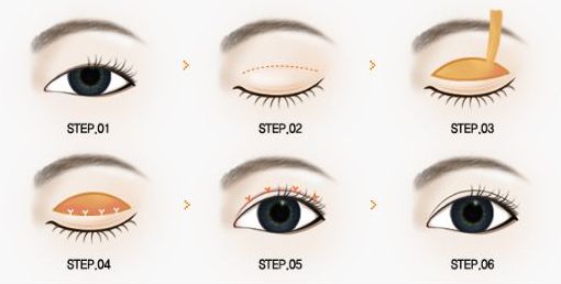 北京301整形科醫(yī)生評(píng)價(jià)和患者反饋