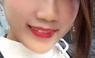 想要做隆鼻手術如何避免不好的經(jīng)歷？成功隆鼻必備指南！