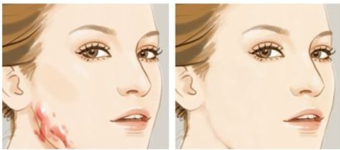 北京黃寺整形醫(yī)生資料及2023鼻部整形收費詳情揭秘！