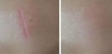 楊嫻嫻整形醫(yī)生技術(shù)與實力揭秘