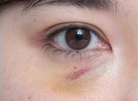 上海市那家醫(yī)療機(jī)構(gòu)的鼻整形效果較好呢？