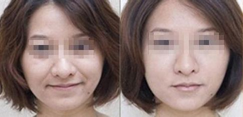 成都有哪些專業(yè)的雙眼皮整形醫(yī)生值得推薦？