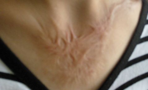 杭州著名雙眼皮醫(yī)生推薦，高口碑為你揭曉