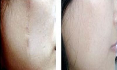 合肥專業(yè)磨骨手術(shù)醫(yī)院：醫(yī)術(shù)精湛，信譽(yù)有保障！