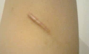 上海顧清整形哪家醫(yī)院好？看看口碑評(píng)價(jià)和隆鼻案例