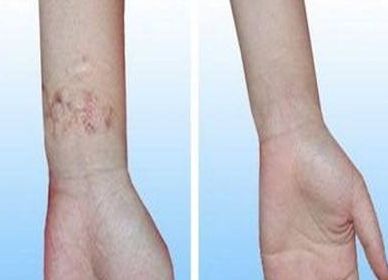 了解邯鄲京美整形醫(yī)生團(tuán)隊(duì)，醫(yī)生介紹及價(jià)格表邯鄲京美整形醫(yī)院的醫(yī)生團(tuán)隊(duì)介紹及特色項(xiàng)目與價(jià)格