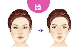 衡陽附二可信度高的雙眼皮手術醫(yī)生與案例分享