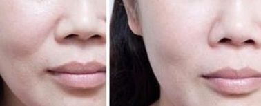 南通割雙眼皮醫(yī)生排行前八名名單公布！五星推薦供參考