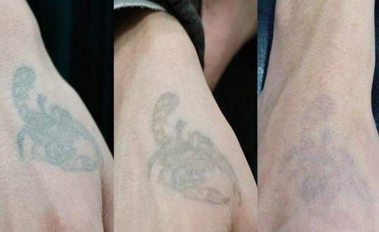 長(zhǎng)沙哪家整形醫(yī)院技術(shù)靠譜？私立醫(yī)美還可信嗎？