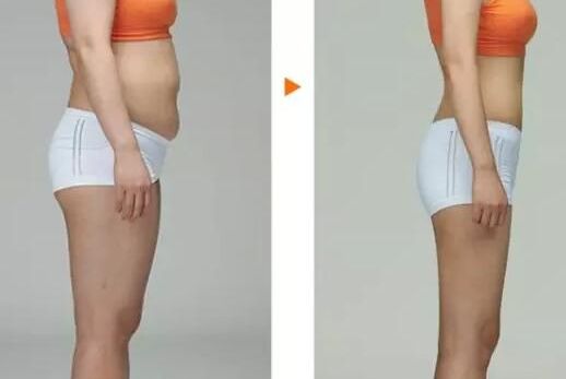 上海下頜角整形領先醫(yī)院揭曉！這三家醫(yī)院有華美、美聯(lián)臣與伊萊美！