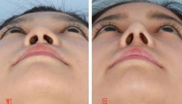 無(wú)錫市更受歡迎的吸脂醫(yī)院排行榜2023！這3家醫(yī)院赫然在列