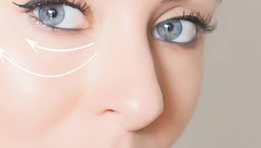 深圳著名整容大師向宏偉醫(yī)生的最新隆鼻案例揭秘