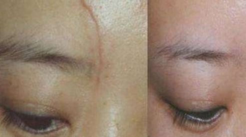 西京醫(yī)院美容科的醫(yī)師團(tuán)隊(duì)與隆鼻優(yōu)質(zhì)服務(wù)如何？