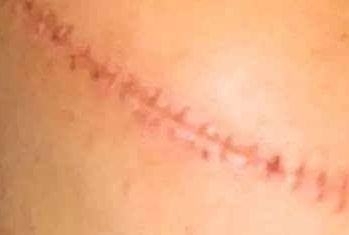 廣州2023年推薦的10位贊譽卓越的玻尿酸醫(yī)師