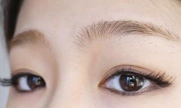 浙二醫(yī)院整形科包祺雙眼皮效果如何？專家簡介及成功案例分享