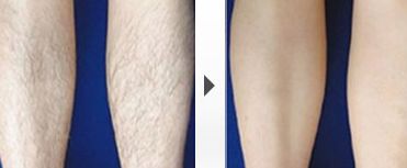 上海頂尖整形外科專家排行榜名單曝光！實(shí)力強(qiáng)弱一目了然！