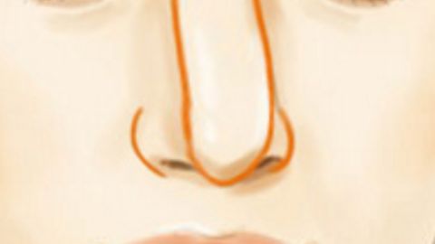 南京私密整形——關(guān)于這個(gè)你或許不知道的小秘密