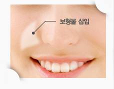 廣州韓后醫(yī)療美容門診部真的靠譜嗎？值得信賴嗎？他們擅長(zhǎng)哪些整形項(xiàng)目？技術(shù)水平如何？