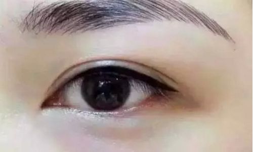 如何掛號(hào)預(yù)約肖博醫(yī)生的西京醫(yī)院？了解雙眼皮手術(shù)費(fèi)用的參考案例。