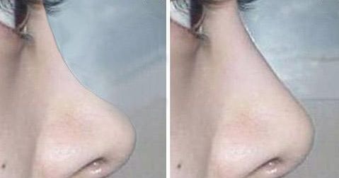 無錫最新醫(yī)美熱門！高人氣整形醫(yī)院揭秘，信譽(yù)在線！