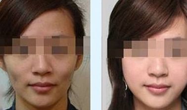 京城創(chuàng)新！北京隆鼻專家前十強揭曉：專業(yè)實力過人，代表強勢入圍！