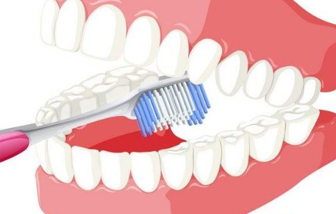 獨特魅力之李映雨隆胸歷程，魔法技藝完美呈現