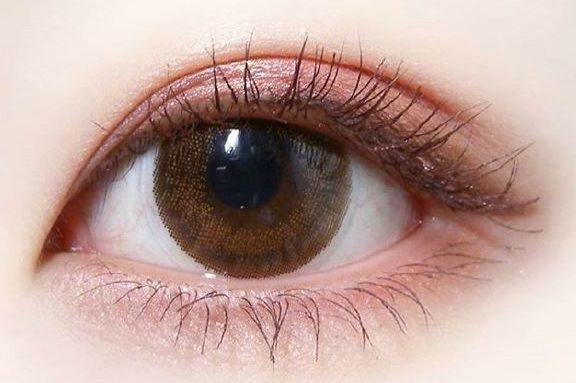 做雙眼皮的技術(shù)及效果，近年治療體驗(yàn)發(fā)布解析