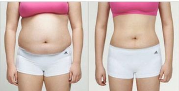 廣州優(yōu)秀整形醫(yī)院排名前三，看看美恩、荔醫(yī)、曙光的口碑如何