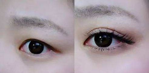 上海九院張英為雙眼皮手術(shù)的明星醫(yī)生，獨(dú)具醫(yī)術(shù)絕技。