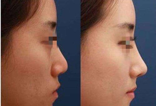 重慶愛思特整形美容醫(yī)院團(tuán)隊的技術(shù)一覽，值得信賴嗎？