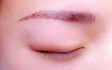 北京打玻尿酸首選！猛戳熱搜榜，解鎖姐妹們的心聲！