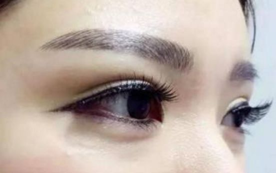 2023年最受認(rèn)可的國(guó)內(nèi)拉皮手術(shù)醫(yī)生排行榜，頂尖專(zhuān)家名單公布