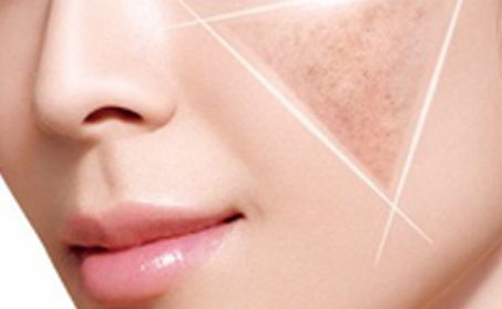 卿勇隆鼻效果如何？專家所屬醫(yī)院披露