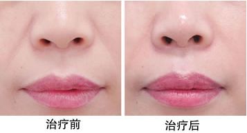 最靠譜的蘇州下頜角整形醫(yī)院推薦，口碑爆棚的醫(yī)療機構(gòu)評選