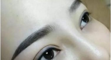 北京哪個(gè)醫(yī)院治療胎記效果好？這家醫(yī)院備受推崇