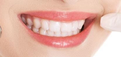 2023年一覽廈門最新雙眼皮醫(yī)療機構-替代列表中，星系、顏王等上榜，自主選擇美容服務！