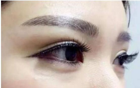 經(jīng)驗豐富！華西地區(qū)雙眼皮重點醫(yī)生推薦，名單揭秘！