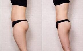 揭曉！揭秘武漢市最出色的肋鼻治療醫(yī)生榜單TOP5