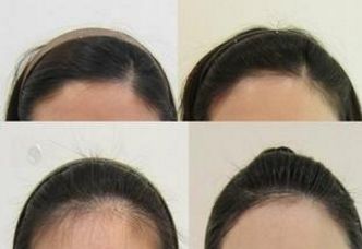 上海久愿整形醫(yī)院：醫(yī)術(shù)高超的專家團隊及服務(wù)費用展示